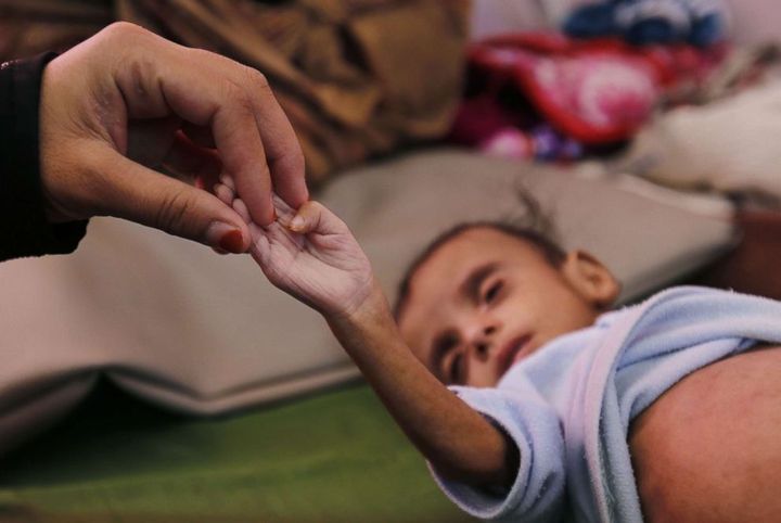 Week of Action on Yemen